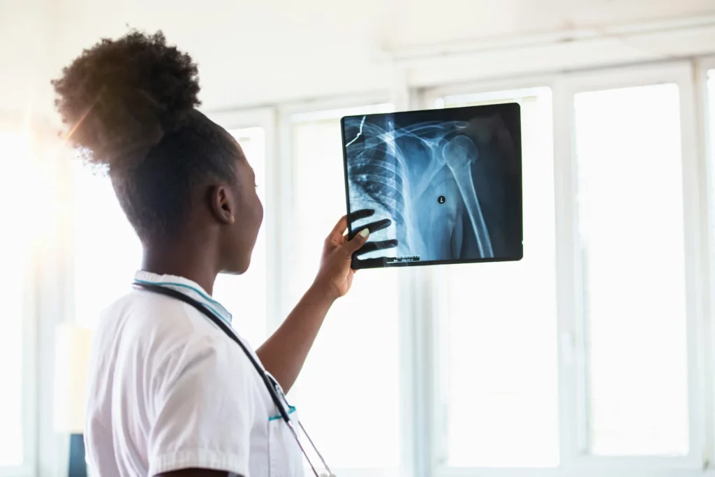 photo - a specialists looking at an x-ray thinking about her travel rad tech salary